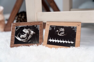  Ultrasound Picture Frame